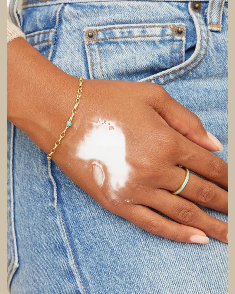 Jennifer Meyer turquoise ring - Gold Gold