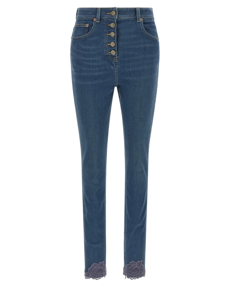 Valentino Garavani Lace-Insert Skinny Jeans — Blue Blue