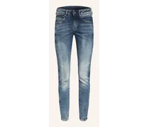 Skinny Jeans ARC